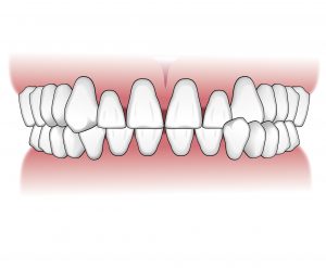 Tratamientos-ortodoncia-intro-02