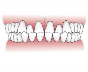 Tratamientos-ortodoncia-intro-03