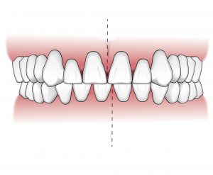 Tratamientos-ortodoncia-intro-04