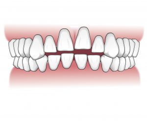 Tratamientos-ortodoncia-intro-05