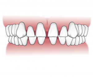 Tratamientos-ortodoncia-intro-06
