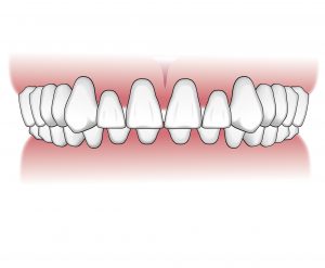 Tratamientos-ortodoncia-intro-07