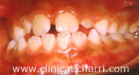 Fig 14-081 copia